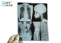 Film-trockener X Ray 10 * 12 Zoll HAUSTIER medizinischer Bildgebung Film für Tintenstrahl-Drucker