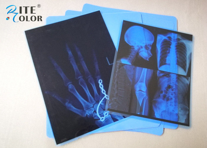 Film der niedriger Nebel blauer HAUSTIER Tintenstrahl-medizinischen Bildgebung 8 x 10 Zoll für Epson-Drucker