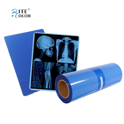 IMATEC Blaue PET-Tintenstrahl-Röntgenfilm für die medizinische CR-Röntgenfotografie für Canon-Drucker