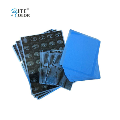 Tintaufdruck PET Blaue medizinische Folie für Röntgenstrahlen A4 8x10 14x17 Blätter