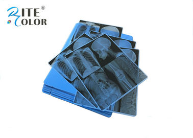 Medizinisches blaues empfindliches Material HAUSTIER Film X Ray für Bild-Tintenstrahl-Drucken