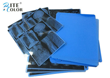 11 x 14 Film Zoll-Laser-Darstellungs-Film A4 HAUSTIER Tintenstrahl-medizinischer trockener X Ray für CT-CR MRT