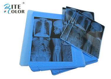 Stärke medizinischer Bildgebung Radiologie-blaue X Ray des Film-210um für Epson-Tintenstrahl-Drucker