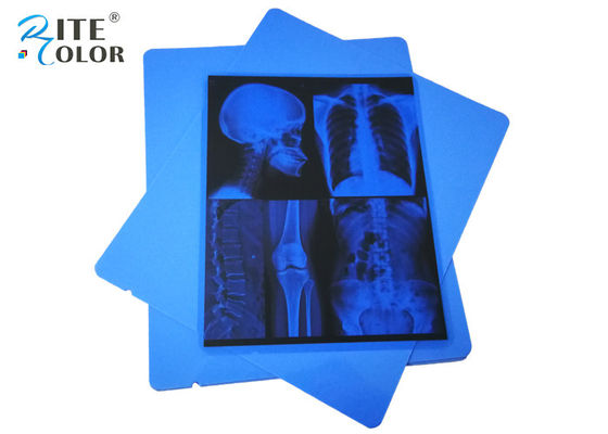 Niedrignebel A4 Blau PET Trockenpigment Tintenstrahl 210 Mikron Medizinischer Röntgenfilm Ökofreundlich