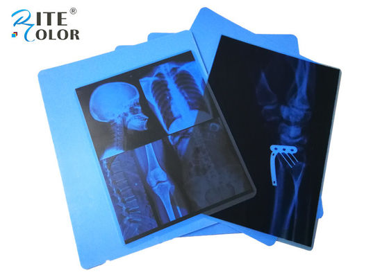 Blaue X Ray Film For Canon Pixma Drucker Tintenstrahl HAUSTIER medizinischer Bildgebung