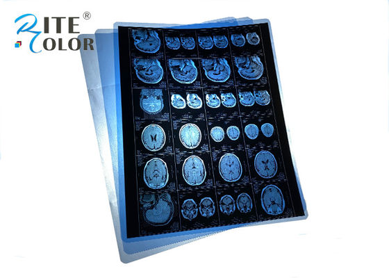 Wasserdichtes PET Blaues Medizinisches Röntgenfilm für MRT CT CR Zahnpanoramabildenausgabe