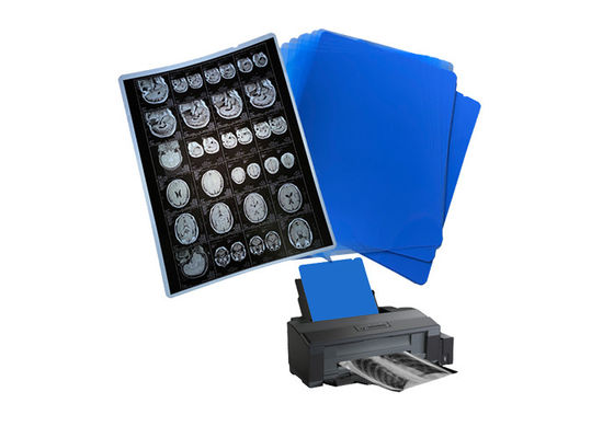 210um 8x10 A3 A4 Blaue medizinische Tintenstrahlfilm für die Röntgenbildausgabe